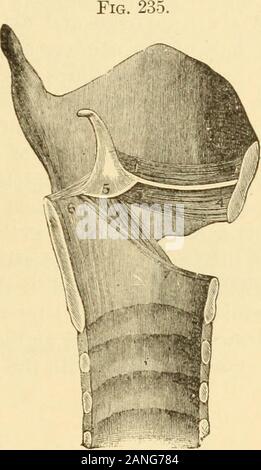 Ein text-Buch über Erkrankungen der Hals-, Nasen- und Ohren. Muskeln des Kehlkopfes, von hinten gesehen.{Browne.) 1, 2, cricoid Knorpel; 3, 4; 5, 6 arytenoidmuscle. schildknorpel, 7, 8, zungenbein; 9, 12, Knorpel von Santorini; 10, 13, Knorpel ofWrisberg; 11, 14, 15, kehldeckel; 16, der Luftröhre; 17, dicker (Kissen) Teil der epiglottis; 18, 19, hinterer crico - arytenoid Muskeln; 20, 21, 22, 23, arytenoid.. Seitliche Sicht auf den Kehlkopf, die Innenausstattung der linken Hälfte. (Browne.) 1, 2, 3, 4, Links vocal bandand thjTO - arytenoid Muskel; 5, links arytenoidcartilage; 6, 7, cricoid Knorpel; 5, 7, Stockfoto