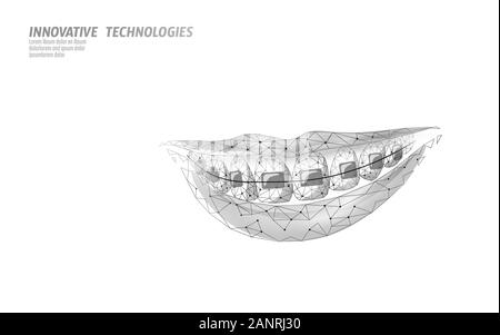 Kieferorthopädische 3D-Zahnspangen. Wonam lächelt Zahntrainer. Medizinisches Banner für dentale Theater-Gesundheitspflege. Zahnarztkorrekturvektor mit niedrigem Poly-Design Stock Vektor