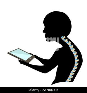 Text-Nacken-Syndrom. Wirbelsäulenverkrümmung, Kyphose, Lordose des Halses, Skoliose, Arthrose. Unsachgemäße Haltung und Stoop. Schwarz-weiße Silhouette Stock Vektor