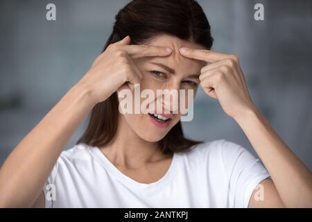 Kopf geschossen unglückliche Frau Kontrolle der Akne, Pickel auf Stirn zusammendrücken. Stockfoto