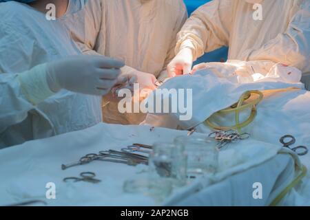 Nahaufnahme, Hände einer OP-Schwester, medizinische Instrumente von einem sterilen Tisch, vor dem Hintergrund der ein Team von Ärzten, den Betrieb. Stockfoto