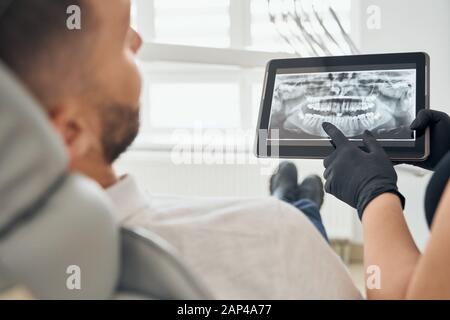 Junger bärtiger Mann, der im Zahnstuhl sitzt und auf dem Tablett das Zahnbild betrachtet, das den Zahnarzt in schwarzen Handschuhen hält. Professioneller Arzt, der die Mundhöhle des männlichen Patienten untersucht. Stockfoto