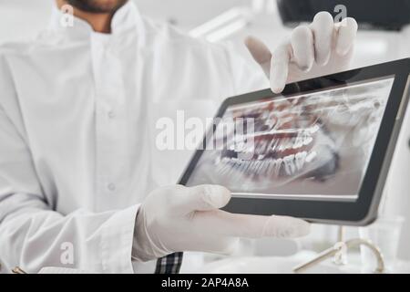 Nahaufnahme der elektronischen Tablette mit Röntgenbildern der Zähne des Kunden, die den männlichen Arzt in weißen Gummihandschuhen halten. Professioneller Zahnarzt, der moderne Technologien in der Mundbehandlung verwendet. Stockfoto