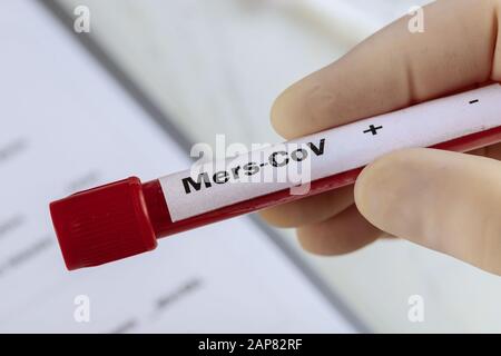 MERS-COV Bluttestgerät eine von mehreren Reagenzgläsern mit MERS-Virusdefinition Stockfoto