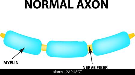 Normales Axon. Gesundes Myelin. Tag Der Multiplen Sklerose Der Welt. Infografiken. Vektordarstellung auf isoliertem Hintergrund. Stock Vektor