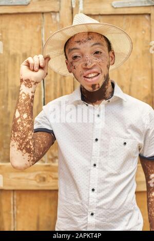 Porträt des jungen Mannes mit Vitiligo, der einen Hut trägt Stockfoto