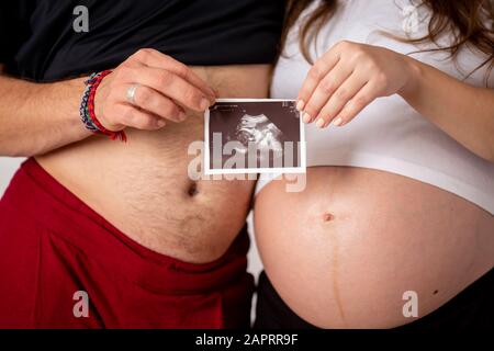 Glückliches Ehepaar zeigt Schwangerschaftstest und Ultraschallbild ihres ungeborenen Babys. Konzentrieren Sie sich auf zwei Streifen Stockfoto