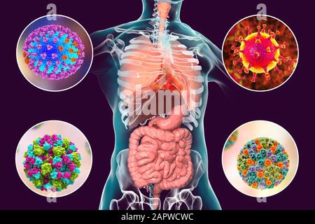 Virale Atemwegsinfektionen und enterische Infektionen, Abbildung Stockfoto