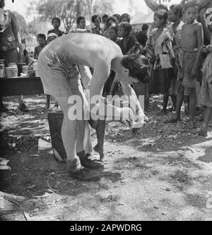 Reportage Madura Madura: Aufgrund von Vernachlässigung und Mangel an medizinischen Kräften und Medikamenten hat sich die öffentliche Gesundheit auf Madura während der republikanischen Herrschaft deutlich verschlechtert. Ein Fall von Ulcus tropica - tropisches Geschwür, eine häufige Infektionskrankheit - wird von der Krankenschwester Van Hees der K.M. in Verbindung gebracht Datum: August 1947 Ort: Indonesien, Madura, Niederländische Ostindien Stockfoto