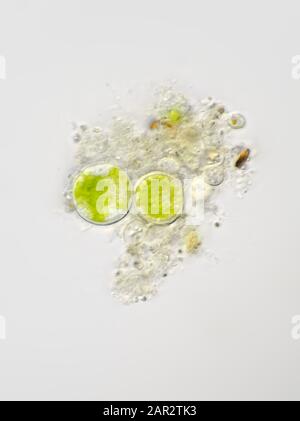 Photomikrograph einiger runder Algen und Wasserschutt, vertikales Sichtfeld liegt bei etwa 116 Mikrometer Stockfoto
