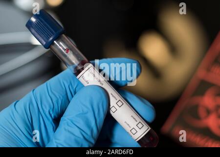 Medizinische Ebola-Virus-Untersuchung des Blutes der Patienten in der Durchstechflasche. Nahaufnahme der Blutprobe mit Handschuhen, um auf Ebola-Virus zu testen. Globale Pandemiewarnung. Stockfoto