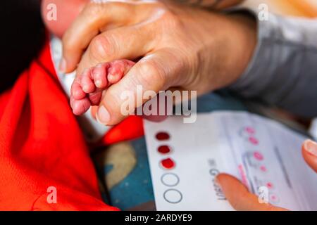 Ein selektiver Fokusschuss als Hebammelschwester führt Gesundheitskontrollen an einem neugeborenen Baby durch und nimmt Blutproben vom Fuß, um auf seltene Bedingungen zu prüfen Stockfoto