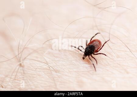 Nahaufnahme von Hundeticken auf der menschlichen Hautoberfläche. Parasiten, Enzephalitis, lyme-krankheit, Impfung und Gesundheitskonzepte. Stockfoto