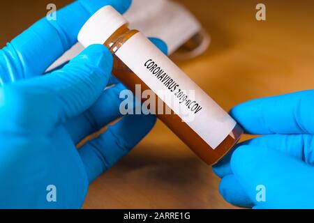 Arzt, der einen positiven Blutprobenschlauch mit Coronavirus beschriftet Stockfoto