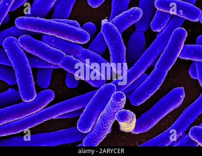 Rasterelektronenmikrograph von Escherichia coli Stockfoto