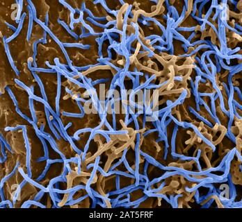 Ebola Virus on Cell. BOLA Virus Disease (EVD) ist eine tödliche Krankheit mit gelegentlichen Ausbrüchen, die vor allem auf dem afrikanischen Kontinent auftreten. Am häufigsten trifft die EVD auf Menschen und nichtmenschliche Primaten (wie Affen, Gorillas und Schimpansen). Sie wird durch eine Infektion mit einer Gruppe von Viren innerhalb der Gattung Ebolavirus verursacht: Ebolavirus (Spezies Zaire ebolavirus) Sudan-Virus (Species Sudan ebolavirus) Taï Waldvirus (Species Taï Forest ebolavirus, früher Côte d'Ivoire ebolavirus) Bundibugyo-Virus (Species Bundibugyo ebolavirus) Reston Virus Stockfoto