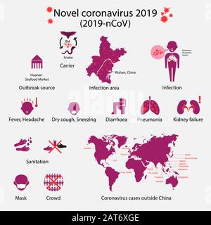 Roman Coronavirus 2019 Infografiken. 2019-nCoV.A neues Atemvirus erstmals in der chinesischen Stadt Wuhan.Vector Illustration entdeckt. Stock Vektor