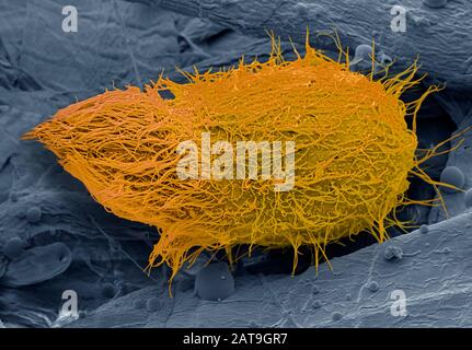 Loxophyllum ciliate protozoa, Sem Stockfoto