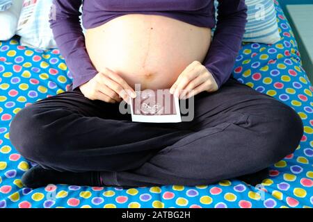 Röntgenaufnahme eines Fötus und des Bauches, der ihn während der Schwangerschaft enthält. Sie gehören einer jungen Kaukasusfrau an. Stockfoto