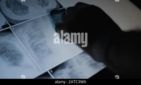 Konzept der Lungenradiographie: Radiologiearzt, der den Röntgenfilm des Patienten im Krankenhausraum auf der Brust untersucht. Medizinisches Konzept. Stockfoto