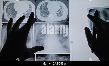 Professionelles medizinisches Team, das die Radiographie eines Patienten untersucht, medizinisches Konzept. Stockfoto