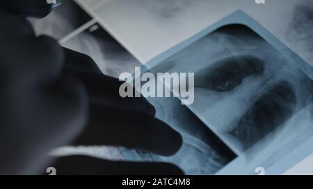 Arzt untersucht Röntgenfilm des Patienten im Krankenhaus.medizinisches Konzept. Stockfoto