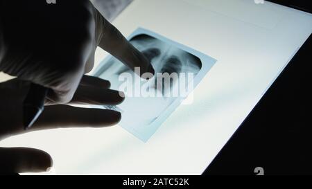 Arzt auf Röntgenbild der Brust prüfen. Der Mann, der die Radiographie betrachtet. Wirbelsäulenuntersuchung, Anatomie, Wissenschaft, Beruf, Unfallkonzepte für Patienten Stockfoto