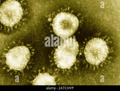 Gereinigte Coronavirus-Partikel unter Transmissionselektronenmikroskopie (TEM) Stockfoto
