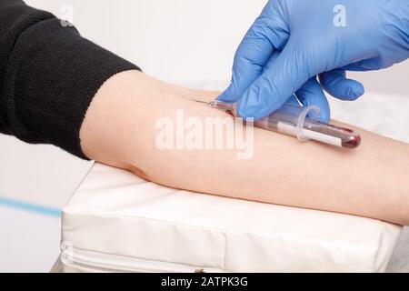 Nahaufnahme des Arztes oder der Krankenschwester, die Blut aus der Armvene eines Patienten mit einem Staubsauger sammelt. Venenpunktion oder Venenpunktion Stockfoto