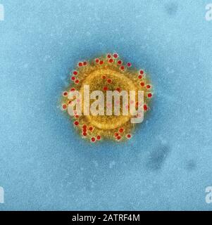Hochgradig vergrößertes, digital koloriertes Transmissionselektron-mikroskopisches (TEM)-Bild der Teilchenhülle eines einzigen, kugelförmigen, mittelostrespiratorischen Syndrom-Coronavirus (MERS-COV)-Virions, 2014. Mers gehört zur selben Familie wie das neue Coronavirus, das Anfang 2020 in Wuhan, China, Patienten infizieren begann. Höflichkeit National Institute of Allergy and Infectious Diseases (NIAID)/CDC. 2014 produziertes Bild. () Stockfoto