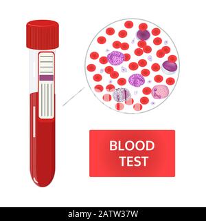 Medizinisches Vektorkonzept. Blutanalyse in Reagenzgläsern und Blutzusammensetzung unter dem Mikroskop. Rote und weiße Blutkörperchen, Thrombozyten Bild. Stock Vektor