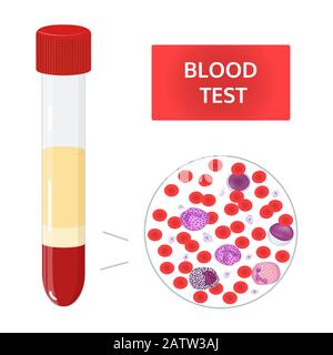 Medizinisches Vektorkonzept: Blutanalyse in Reagenzgläsern und Blutzusammensetzung unter dem Mikroskop. Rote und weiße Blutkörperchen, Thrombozyten Bild. Stock Vektor