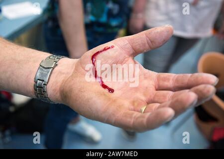 Der Mann wird in der Hand verletzt. Blut fließt aus der Hand, das durch einen Schnitt verursacht wird Stockfoto