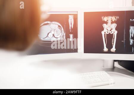 Magnetresonanztomographie. Nahaufnahme MRT-Scan ergibt Krebsarzt. Stockfoto