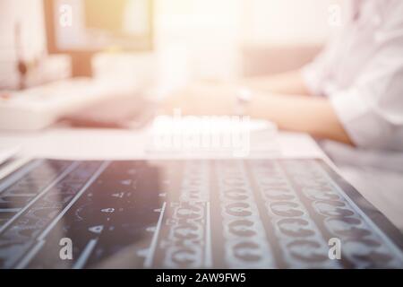 Magnetresonanztomographie. Nahaufnahme MRT-Scan ergibt Krebsarzt. Stockfoto
