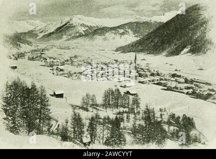 Tuberkulose im Säuglingsalter und Kindesalter: Ihre Pathologie, Prävention und Behandlung. Aber ich bezweifle, ob tatsächlich irgendein anderes Kurort gefunden werden könnte, in dem ein solches Risiko geringer ist als in Davos. Davos steht allein unter den Kurorten in den strengen Infektionsvorkehrungen. In einer großen Anzahl von Gesundheitsresorten wird die Aussage gemacht, dass an Tuberkulose erkrankte Invaliden nicht erhalten werden. Die übliche Bedeutung ist lediglich, dass keine Vorkehrungen für ALPINE KLIMAZONEN getroffen werden 265. In Davos muss jedes Risiko einer Infektion mit dem Tuberkel sicherlich als infinitesimal überegardet werden. Die Deutschen haben u. a Stockfoto