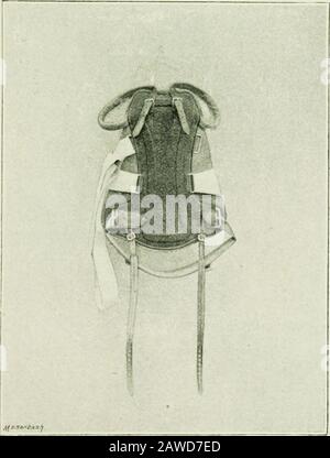 Tuberkulose im Säuglingsalter und Kindesalter: Ihre Pathologie, Prävention und Behandlung. E, die immer außerhalb ihrer Gasse liegen, sind besser als in einer Krankenhausstation unter vorbildlichen sanitären Superheitsicht. Gute frische Luft und Sonnenschein sind für die Tuberculouschildren unerlässlich und sollten für sie um jeden Preis gesichert werden. Wherevermoeglich, sie sollten tagsüber im Freien und nachts in einem Zelt stehen. Mit der Leitung von Krankenhäusern in der Mitte des Landes sowie in der Stadt spricht der Schriftsteller mit der Autorität einer außergewöhnlichen Erfahrung, wenn er sich für die Freilandluft ausspricht. Wenn thi Stockfoto