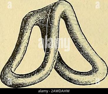 Traité de gynécologie clinique et opératoire . e placerlorsque la femme est dans la Position latéraleou genu-pectorale. On na quà aller loger laparie supérieure du pessaire dans le cul-de-sacpostérieur, et à labandonner ensuite à lui-même en repoussant un peu sa Partie anté-rieure, pour quil se place automatiquement.On choisit ses Dimensions daprès celles duvagin. UN pessaire qui ne blesse pas la maladepeut être sans inconvénients laissé en placedeux et trois mois; il nempêche ni le coït ni FIG. 253.-Pinces pour Rim™la fécondation. Au bout de ce temps, on le ^eZmltpaiïe™ annretire pour le ne Stockfoto