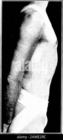 Angewandte Anatomie und Kinesiologie, der Mechanismus der muskulären Bewegung . HE Rippen. Das Diaphragma muss die Bauchwand immer gegen den Druck der Atmosphäre ausdrücken, was beträchtlich ist, aber die Atmung ist effizienter, wenn die Bauchwände stark und gut bemuskelt sind. Die gleichzeitige Kontraktion der Interkosten und Membranen dehnt den Brustkorb in alle Richtungen aus und bewirkt so Inhalation;bei ruhiger Atmung ist dies die einzige muskuläre Aktion, die plakativ wirkt, mit Ausnahme der Muskeln in den Wänden der Bronchial 234-ATEMSCHLÄUCHE, die nicht gleich vielfältig sind und nicht Stockfoto