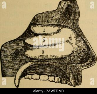 Die Grundlagen von healthA Textbuch der Anatomie, Physiologie, Hygiene, Alkohol und Betäubungsmittel. Abb. 108. Transversektion der Frameworkof der Nase : (1) die Nasalhöhlen. Auf der Außenseite jeder Kavität befinden sich die gekurrten, turbinierten Knochen;(2) die Knochen, die das Mundstück und den Fußboden der Nasenhöhlen bilden.Das schwarze stellt das Knochen dar, das hellere Schatterepräsentiert die mucousmembran, die den Knochen bedeckt. Die Innenseite der beiden, die Seite zur themedianischen Linie hin, ist glatt, da das Septum es-selbst glatt ist; aber die Außenseite ist aufgrund der Präsen-Abb. am unwiderstehlichsten. 109. Die Außenseite des linken n Stockfoto