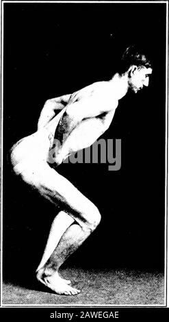 Angewandte Anatomie und Kinesiologie, der Mechanismus der muskulären Bewegung. Die Biegung der Hüfte bei 45 Grad, aber Observationzeigt, dass dieser Muskel untätig ist. Die Vasti-Muskeln sind jedoch eine instrage Kontraktion; das Ausmaß, in dem sie sich verlängern, wird das Ausmaß der Beugung des Knies fixieren; um die erforderliche Position des Schläfens zu geben, müssen die Hamstrings verkürzt werden und der Rektus lengt die Slightlyas die Knie biegen. Da es sich hierbei nicht um eine ererbte Koordination handelt, muss sie durch freiwillige Bemühungen und Übung erlernt werden. 184 BEWEGUNGEN DES KNIEGELENKS Stellt sich nun natürlich die Frage, ob die Stockfoto