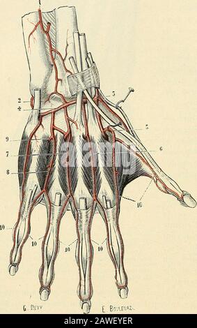 Traité d'Anatomie humaine. maire profonde, soit aveclinterosseuse palmaire corres-pondante: Ces anastomoses sefont à laide de rameaux trèscourts, c{ui traversent en senssagittal les muscles inters-osseux et sont appelés pourcraisette on artères perfo-rantes. après avoir fourniquelcjues artérioles à la Région10, coiaw- métacarpienne, les interosseu-ses dorsales se terminent enfins rameaux sur la face dorsale des doigts. Quelquefois, Cependant, on les voit sebifurquer et donner naissance à deux petits troncs, qui, sous le nom de collaté-rales dorsales, descendent sur les côtés des doigts jusqu Stockfoto