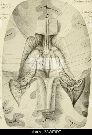 Die Anatomie des Nervensystems, vom Standpunkt der Entwicklung und Funktion. Kation des Chorioid-Plexus des lateralen Ventrikels. Der Plexus chorioid des lateralen Ventrikels (Abb. 183, 184. 188) ist mit dem des dritten Ventrikels am interventrikulären Foramen fortgehüllt, von diesem Punkt aus kann er rückwärts durch den zentralen Teil in das Inferiorhorn gefolgt werden. Sie ist mit der Chorioidfissure koextensiv und wird bei den anterioror posterioren Hörnern nicht gefunden. Es besteht aus einem Gefäßnetzwerk, das aus dem pia 2"C2, DEM NERVÖSEN SYS1 EM mater, und insbesondere aus diesem Teil davon en abgeleitet wurde Stockfoto