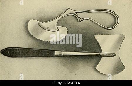 Der Operationssaal und der Patient; eine Anleitung zur vor- und Nachbehandlung . Abb. 107.-^französische Säge zur Entfernung von Gipsabgüssen von Paris. Dies ist wünschenswert, wenn der Gips kurz nach dem Auftreten eines Bruchs aufgetragen wird, da er eine gewisse Schwellung und Alsogen des Gusstaus ermöglicht, der durch die Hände in Kasuswellen auseinander gefedert wird, deutlicher wird. Der Cast zerschnitt also 128 OPERATIXG RAUM AXD DER PATIENT wird von einem Gazenbandage gehalten. Wenn es c-ut unten ist, wenn itsperiod von Nützlichkeit vorbei ist, die vorspringenden Enden des Klebers. Abb. Los - Sägen zum Entfernen von Gips Stockfoto