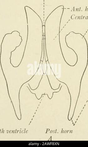 Die Anatomie des Nervensystems aus Sicht der Entwicklung und Funktion . menschliche Gehirnfasern aus dem Körper und Spleniumdes Corpus callosum fegen nach außen über den lateralen Ventrikel und bilden Theroof und Seitenwand seines Hinterhorns und der Seitenwand seines Inferiorcornu. Hier stellen sie eine sehr definitive Schicht dar, die als Tapktum bezeichnet wird. 246 DAS NERVENSYSTEM DER LATERALE VENTRIKEL, Wenn der Corpus callosum und sein Strahlenbogen einen Hohlraum, die Knownas des lateralen Ventrikels, wegschneiden, wird aufgedeckt. Sie wird von Ependyma gesäumt, durchgehend mit der Ependyma]-Auskleidung des dritten Ventrikels durch Stockfoto