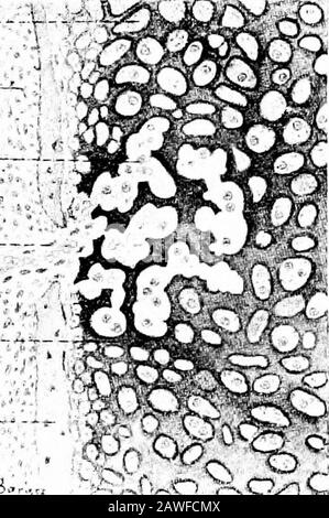 Die Entwicklung des menschlichen Körpers; ein Handbuch der menschlichen Embryologie. In Reihen geostet (Abb. 88) und der Prozess der calci-fication erstreckt sich in Thetrabekular der Matrix, die diese Zeilen voneinander trennen. Whilethere-Prozesse haben den Ort des Mesen-Chyms, das die Thekartilage umgibt, in ein Periosteum (po) umgewandelt, ähnlich wie der des Membranknochens, und die ITsosteoblasten legen einen Laienbein (p) auf die Oberfläche des Knorpels ab. Thecartila-Zellen disapieren nun Birne aus den Intervallen zwischen der trabekularen, ofacalcified Matrix, die ein feines Netzwerk intowhich Massen von Mesen-Chyme bilden (Abb. 89 Stockfoto