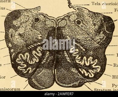 Erkrankungen des Nervensystems . medialis Nucleus olivaris