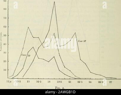 Annalen der Tropenmedizin und Parasitologie. Wir können nun die Fälle in Betracht ziehen, die den Gruppen II und IV der Tabelle II zugeordnet sind Die durchschnittliche Größe der Zysten für die Fälle in Gruppe IIschwankt zwischen i6T/i für Fall 9 und i//.u für Fall 16. Wenn zwischen den beschriebenen Werten ein Größenstamm von E. coli besteht, würde die durchschnittliche Größe seiner Zysten ungefähr 17/i betragen. Anapproximation hierzu wurde für Die Fälle 13 und 14 erzielt, wobei die Durchschnittsgrößen i68/// bzw. I72/// sind. Die für die Messungen der zweihundert Zysten aus 266 Fall 13 erhaltenen Figurenergebnisse sind wie folgt, und sie sind vorgeführt Stockfoto