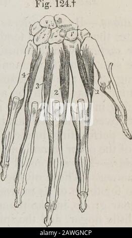 Ein System der menschlichen Anatomie, allgemein und speziell . Der dreizahlige Palmar Interossei wird eher auf die mir-tacarpalen Knochen gelegt, als zwischen ihnen. Sie entstehen aus der Basis des Metakarpalknochens eines Fingers und werden in die Basis der ersten Phalanx- und aponeurotischen Expansion der Extensortendon desselben Fingers eingeführt. Der erste gehört zum Zeigefinger, der zweite zum Ringfinger und der dritte zum kleinen Finger; der Finger wird ausgeschlossen. Relationen.-Durch ihre •palmar Oberfläche mit den Flexorsehnen und mit den tiefen Muskeln in der Handfläche. An ihrem Dorsalrand Stockfoto