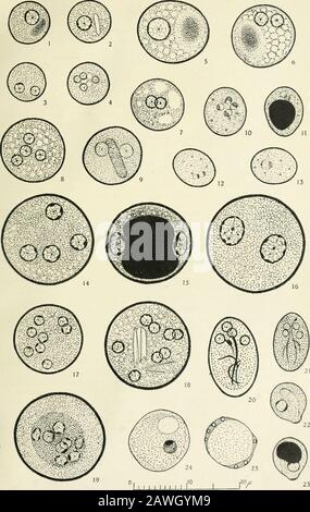 Annalen der Tropenmedizin und Parasitologie. Durchmesser 18-5/1Abb. 17. Acht Nukleinsättigen Zysten. Durchmesser 13/* Abb. 18. Acht Nukleinsäure-Zysten mit spitzen chromatoiden Körpern. Durchmesser i6/&lt;Abb. 19. Wahrscheinlich abnorme 8-Nuklein-Zyste. Durchmesser ij/u Abb. 20-21. Zysten von Giardia Darminalis. Abb. 20. Große braune Färbungszyste. Größe 15// x 9-5/4Abb. 21. Kleine bläulich-graue Färbungszyste. Größe Lo/i x 6-5/1 Abb. 22-23. Zysten von Chilomastix mesnili. Abb. 22, Das Zytostom und der Zellkern deutlich sichtbar. Größe 8-5// x J-^/iiFig. 23. Das Zytostom und der Zellkern sind teilweise durch große, tief stainingmasse von verdeckt Stockfoto